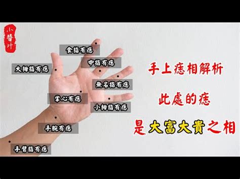 右手中指突然長痣|中指有痣代表含義與寓意分別是什麼